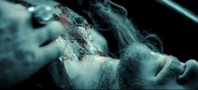 Le corps de Lucian examiné par Alexander Corvinus