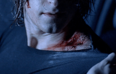 Sélène examine la morsure de Michael